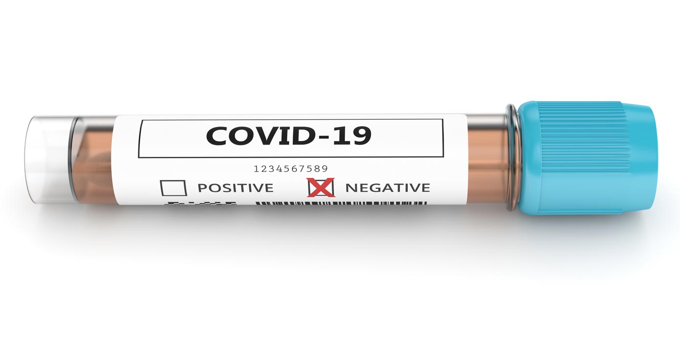 Covid-19-test
